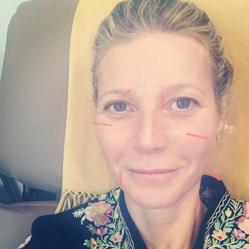 Traditional Chinese Medicine Therapies Are The New Go-To Pre-Wedding Treatments—Just ask Meghan and Gwyneth
